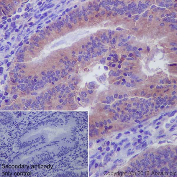 Immunohistochemistry (Formalin/PFA-fixed paraffin-embedded sections) - Anti-MMP14 antibody [EP1264Y] - BSA and Azide free (AB271840)