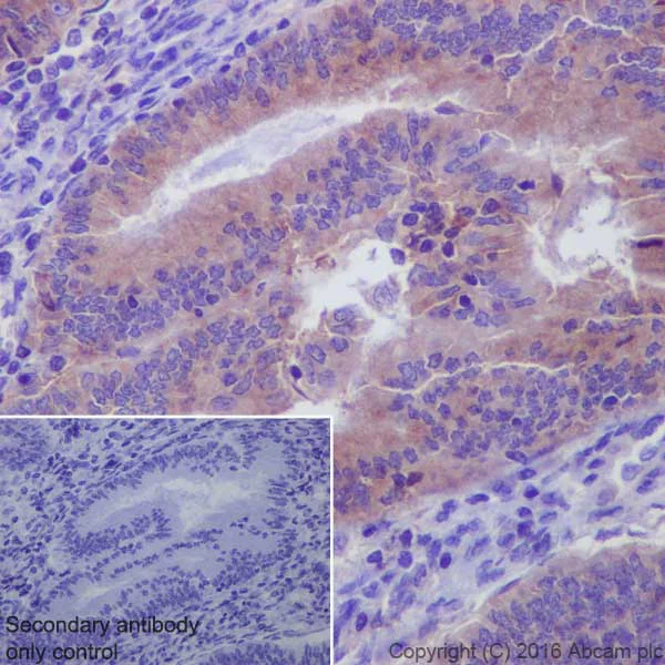 Immunohistochemistry (Formalin/PFA-fixed paraffin-embedded sections) - Anti-MMP14 antibody [EP1264Y] - BSA and Azide free (AB271840)