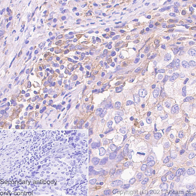 Immunohistochemistry (Formalin/PFA-fixed paraffin-embedded sections) - Anti-MMP14 antibody [EP1264Y] - BSA and Azide free (AB271840)
