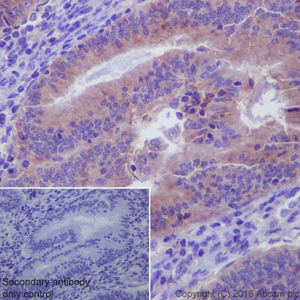 Immunohistochemistry (Formalin/PFA-fixed paraffin-embedded sections) - Anti-MMP14 antibody [EP1264Y] - Low endotoxin, Azide free (AB168726)
