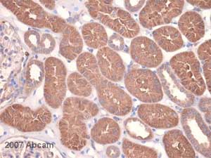 Immunohistochemistry (Formalin/PFA-fixed paraffin-embedded sections) - Anti-MMP14 antibody [EP1264Y] - Low endotoxin, Azide free (AB168726)