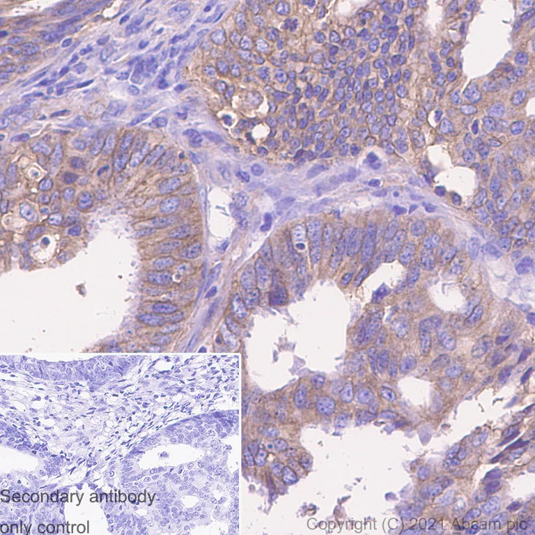 Immunohistochemistry (Formalin/PFA-fixed paraffin-embedded sections) - Anti-MMP14 antibody [EP1264Y] - Low endotoxin, Azide free (AB168726)