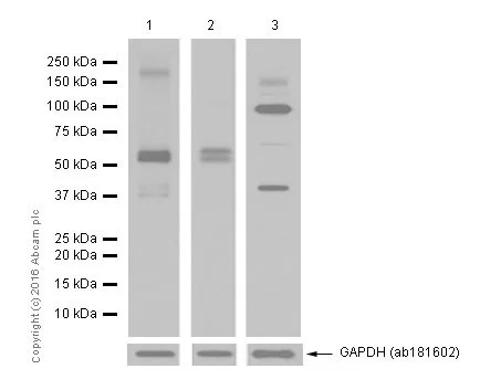Western blot - Anti-MMP14 antibody [EP1264Y] - Low endotoxin, Azide free (AB168726)
