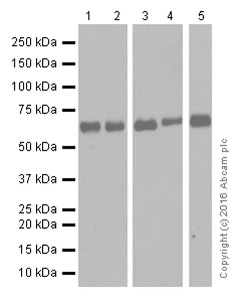 Western blot - Anti-MMP14 antibody [EP1264Y] - Low endotoxin, Azide free (AB168726)