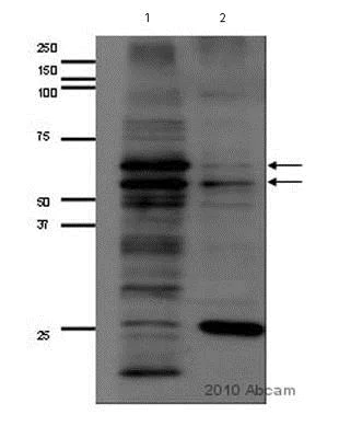 Western blot - Anti-MMP14 antibody - Hinge region (AB38971)
