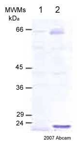 Western blot - Anti-MMP14 antibody - Hinge region (AB38971), expandable thumbnail
