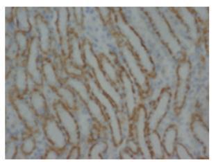 Immunohistochemistry (Formalin/PFA-fixed paraffin-embedded sections) - Anti-MMP16 antibody (AB73877), expandable thumbnail