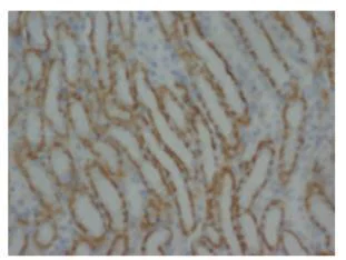 Immunohistochemistry (Formalin/PFA-fixed paraffin-embedded sections) - Anti-MMP16 antibody (AB73877)