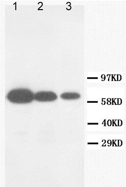 Western blot - Anti-MMP16 antibody (AB73877), expandable thumbnail
