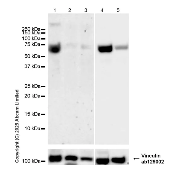 Western blot - Anti-MMP16 antibody [EPR29634-23] (AB325318)