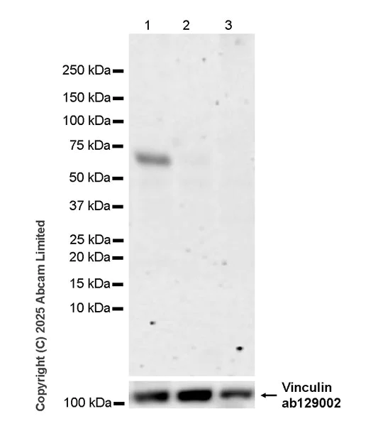 Western blot - Anti-MMP16 antibody [EPR29634-23] (AB325318)