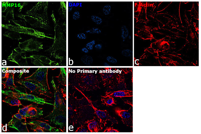 Immunocytochemistry/ Immunofluorescence - Anti-MMP16 Antibody [RP23040073] (AB313410)