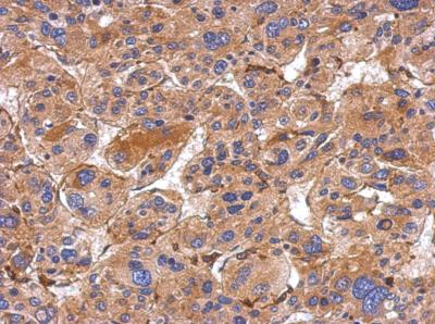 Immunohistochemistry (Formalin/PFA-fixed paraffin-embedded sections) - Anti-MMP19 antibody (AB154496), expandable thumbnail