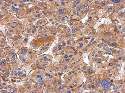 Immunohistochemistry (Formalin/PFA-fixed paraffin-embedded sections) - Anti-MMP19 antibody (AB154496)