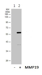 Western blot - Anti-MMP19 antibody (AB154496), expandable thumbnail