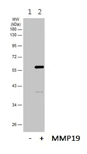 Western blot - Anti-MMP19 antibody (AB154496)