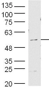 Western blot - Anti-MMP19 antibody (AB216633)