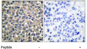 Immunohistochemistry (Formalin/PFA-fixed paraffin-embedded sections) - Anti-MMP19 antibody (AB53146)