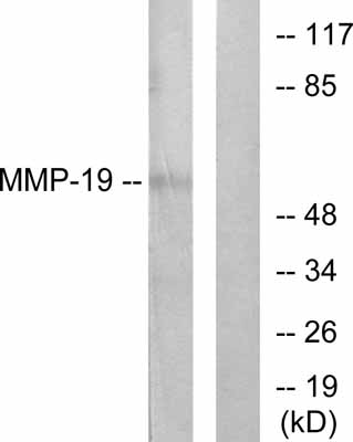 Western blot - Anti-MMP19 antibody (AB53146)