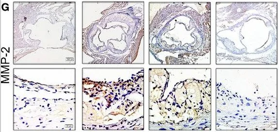 Immunohistochemistry (Formalin/PFA-fixed paraffin-embedded sections) - Anti-MMP2 antibody [6E3F8] (AB86607)
