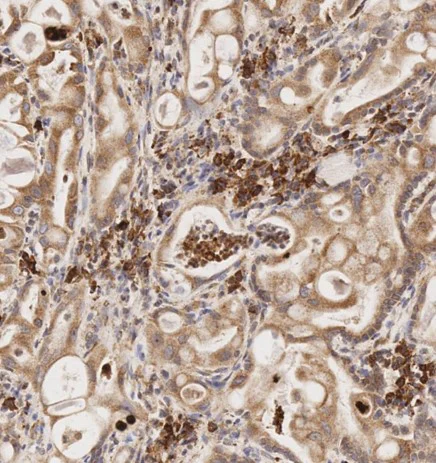Immunohistochemistry (Formalin/PFA-fixed paraffin-embedded sections) - Anti-MMP2 antibody [6E3F8] (AB86607)