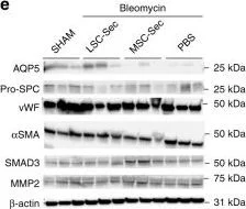 Western blot - Anti-MMP2 antibody [6E3F8] (AB86607)
