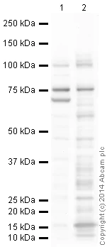 Western blot - Anti-MMP2 antibody [6E3F8] (AB86607)
