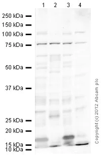 Western blot - Anti-MMP2 antibody [6E3F8] (AB86607)