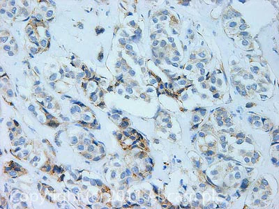 Immunohistochemistry (Formalin/PFA-fixed paraffin-embedded sections) - Anti-MMP2 antibody [6E3F8] - BSA and Azide free (AB264081)