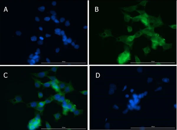 Immunocytochemistry/ Immunofluorescence - Anti-MMP2 antibody (AB235167)
