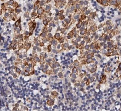 Immunohistochemistry (Formalin/PFA-fixed paraffin-embedded sections) - Anti-MMP2 antibody (AB235167)
