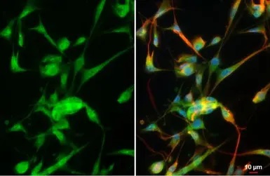 Immunocytochemistry/ Immunofluorescence - Anti-MMP2 antibody (ab97779), expandable thumbnail