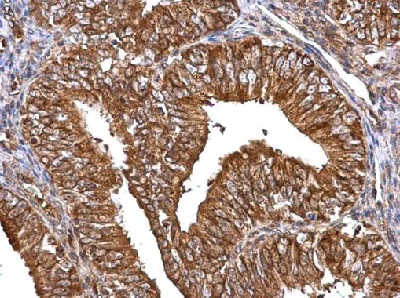 Immunohistochemistry (Formalin/PFA-fixed paraffin-embedded sections) - Anti-MMP2 antibody (AB97779)