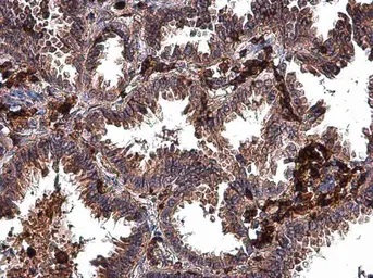 Immunohistochemistry (Formalin/PFA-fixed paraffin-embedded sections) - Anti-MMP2 antibody (ab97779), expandable thumbnail