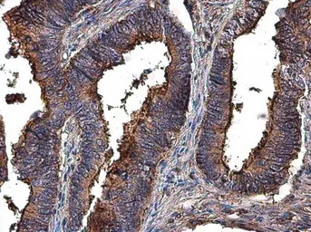 Immunohistochemistry (Formalin/PFA-fixed paraffin-embedded sections) - Anti-MMP2 antibody (ab97779), expandable thumbnail