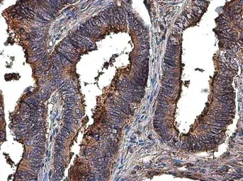 Immunohistochemistry (Formalin/PFA-fixed paraffin-embedded sections) - Anti-MMP2 antibody (AB97779)