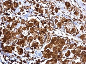 Immunohistochemistry (Formalin/PFA-fixed paraffin-embedded sections) - Anti-MMP2 antibody (ab97779), expandable thumbnail