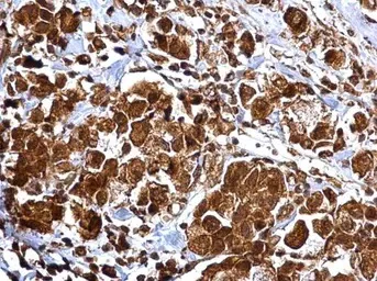 Immunohistochemistry (Formalin/PFA-fixed paraffin-embedded sections) - Anti-MMP2 antibody (AB97779)