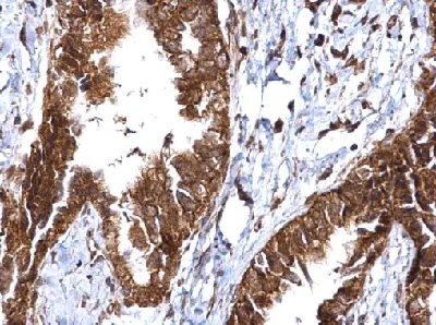 Immunohistochemistry (Formalin/PFA-fixed paraffin-embedded sections) - Anti-MMP2 antibody (AB97779)