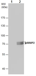 Immunoprecipitation - Anti-MMP2 antibody (AB97779)