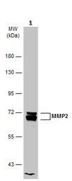 Western blot - Anti-MMP2 antibody (ab97779), expandable thumbnail