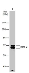 Western blot - Anti-MMP2 antibody (AB97779)