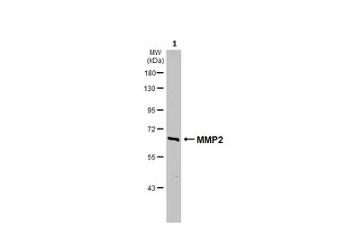 Western blot - Anti-MMP2 antibody (ab97779), expandable thumbnail