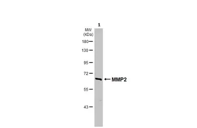 Western blot - Anti-MMP2 antibody (AB97779)