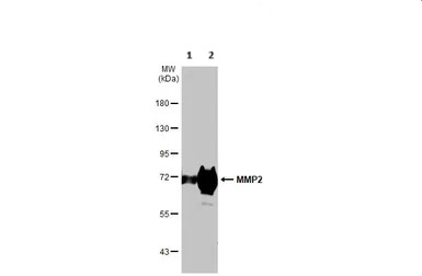 Western blot - Anti-MMP2 antibody (ab97779), expandable thumbnail