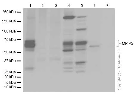 Western blot - Anti-MMP2 antibody [EPR1184] (AB92536)