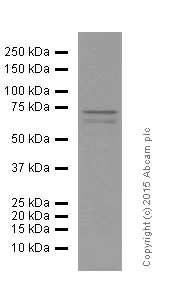 Western blot - Anti-MMP2 antibody [EPR1184] (AB92536)