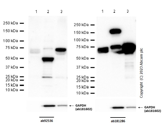 Western blot - Anti-MMP2 antibody [EPR1184] - Low endotoxin, Azide free (AB215986), expandable thumbnail