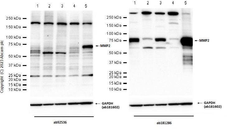 Western blot - Anti-MMP2 antibody [EPR1184] - Low endotoxin, Azide free (AB215986), expandable thumbnail