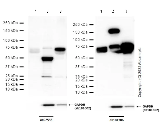 Western blot - Anti-MMP2 antibody [EPR17003-25] (AB181286)